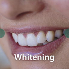 women smiling with bright white teeth